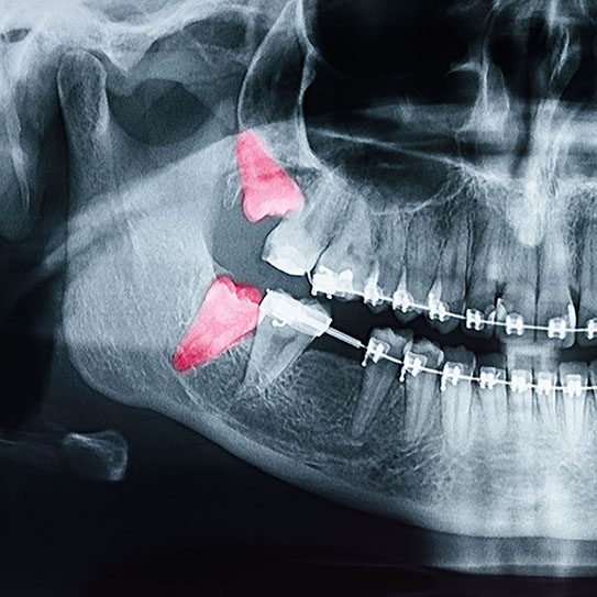 orthodontist pittsburgh