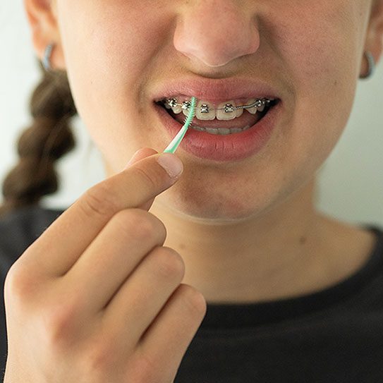orthodontist pittsburgh