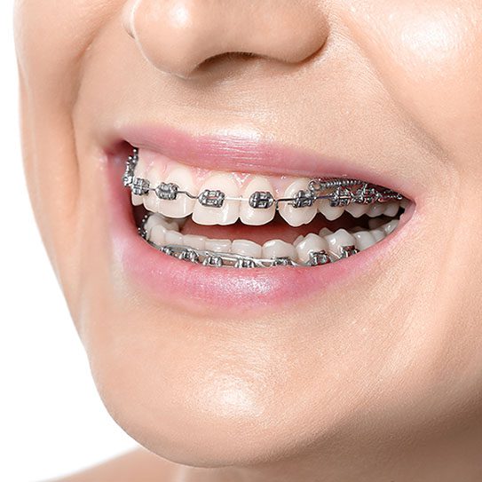 orthodontist pittsburgh