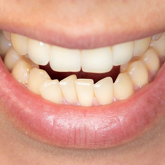 orthodontist pittsburgh