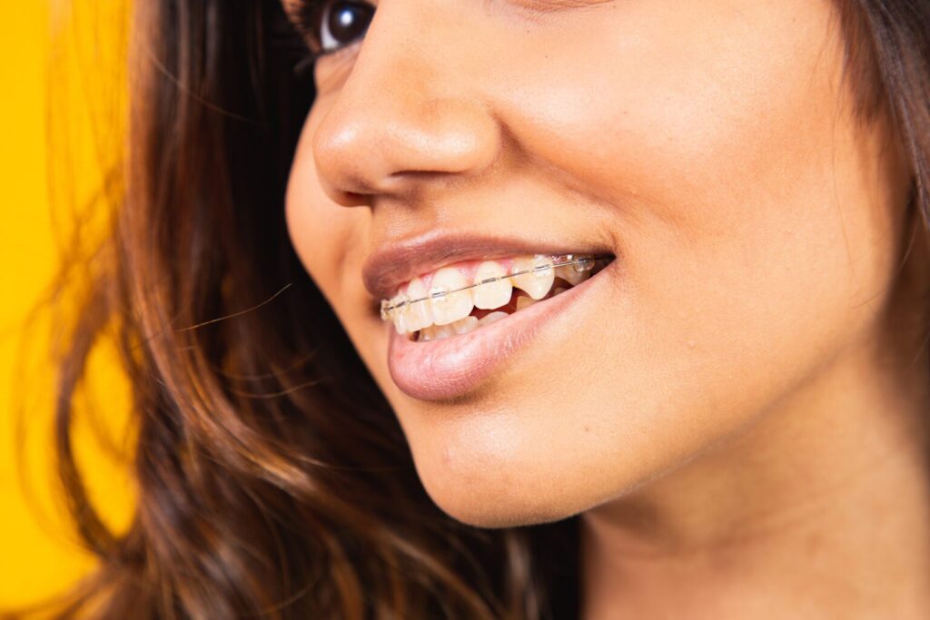 Pittsburgh braces
