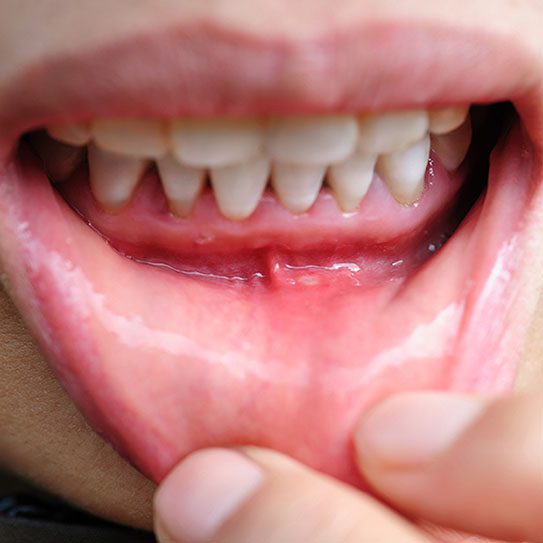 orthodontist pittsburgh